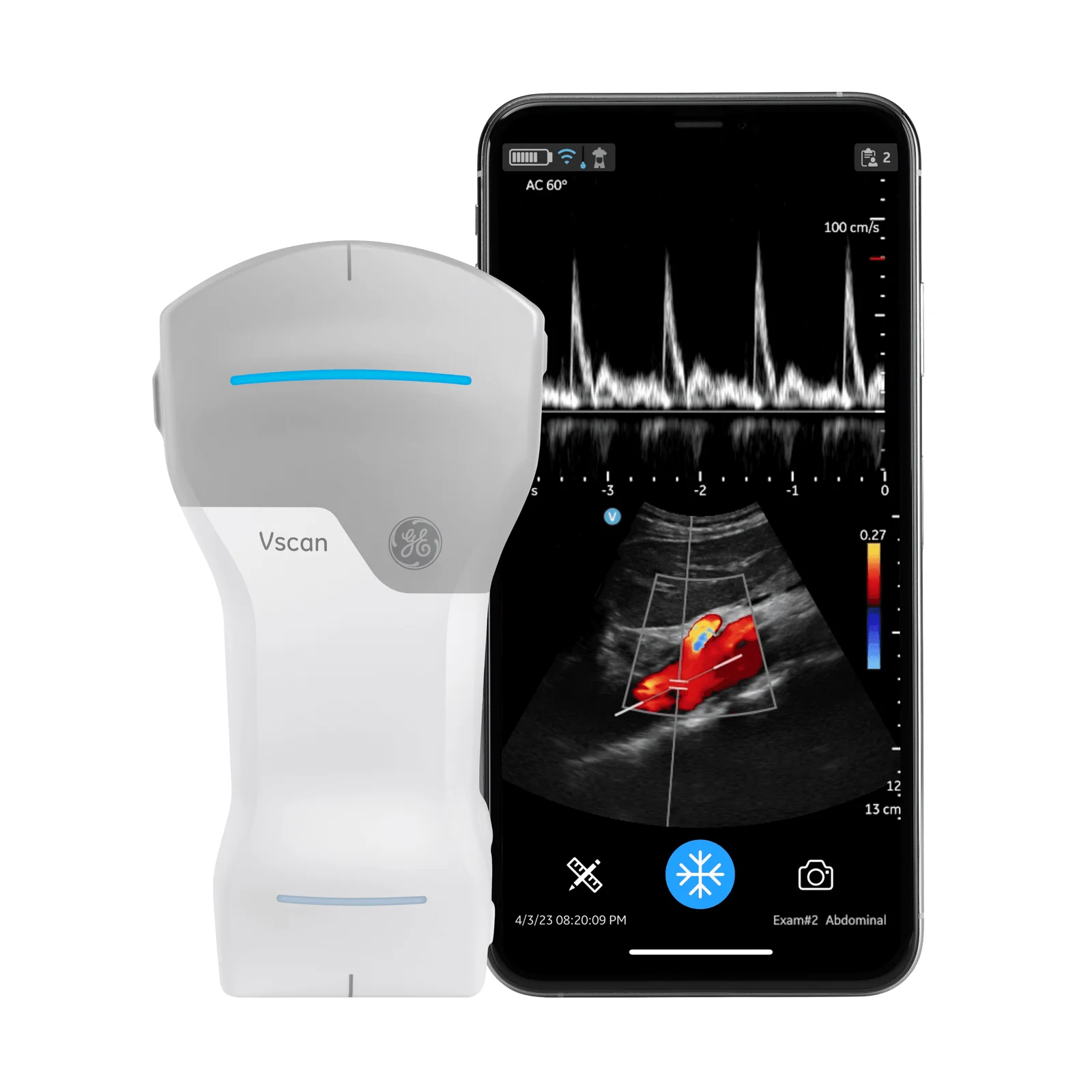 Vscan – CL