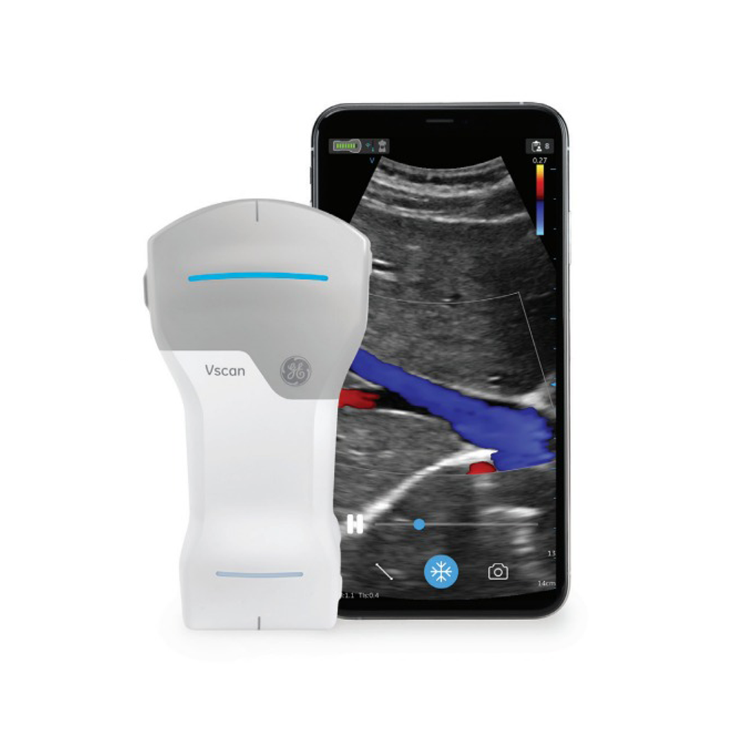 Vscan Air